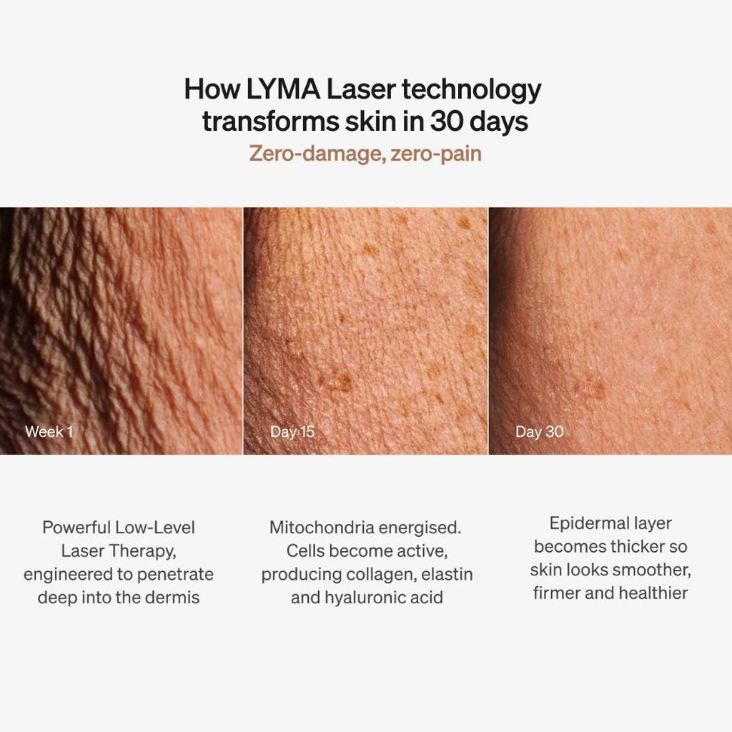 Laser Starter Kit - Image 6