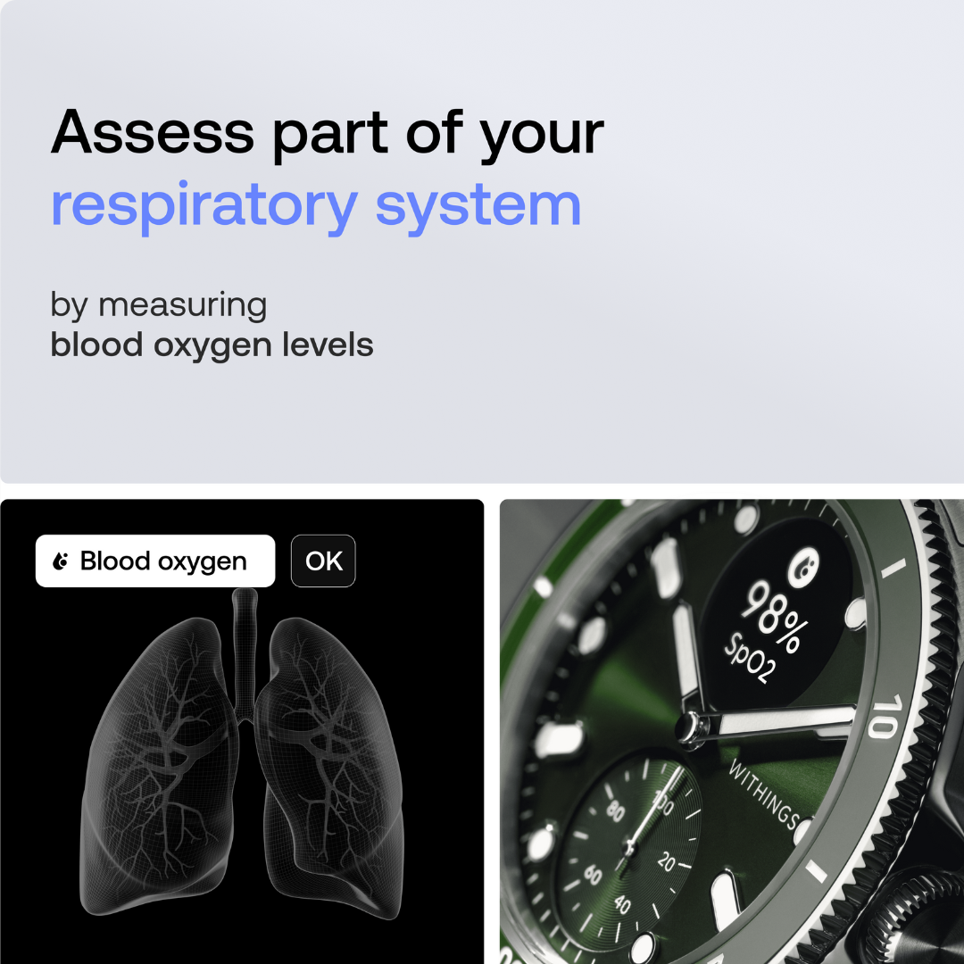 Scanwatch Nova - Green - Image 4