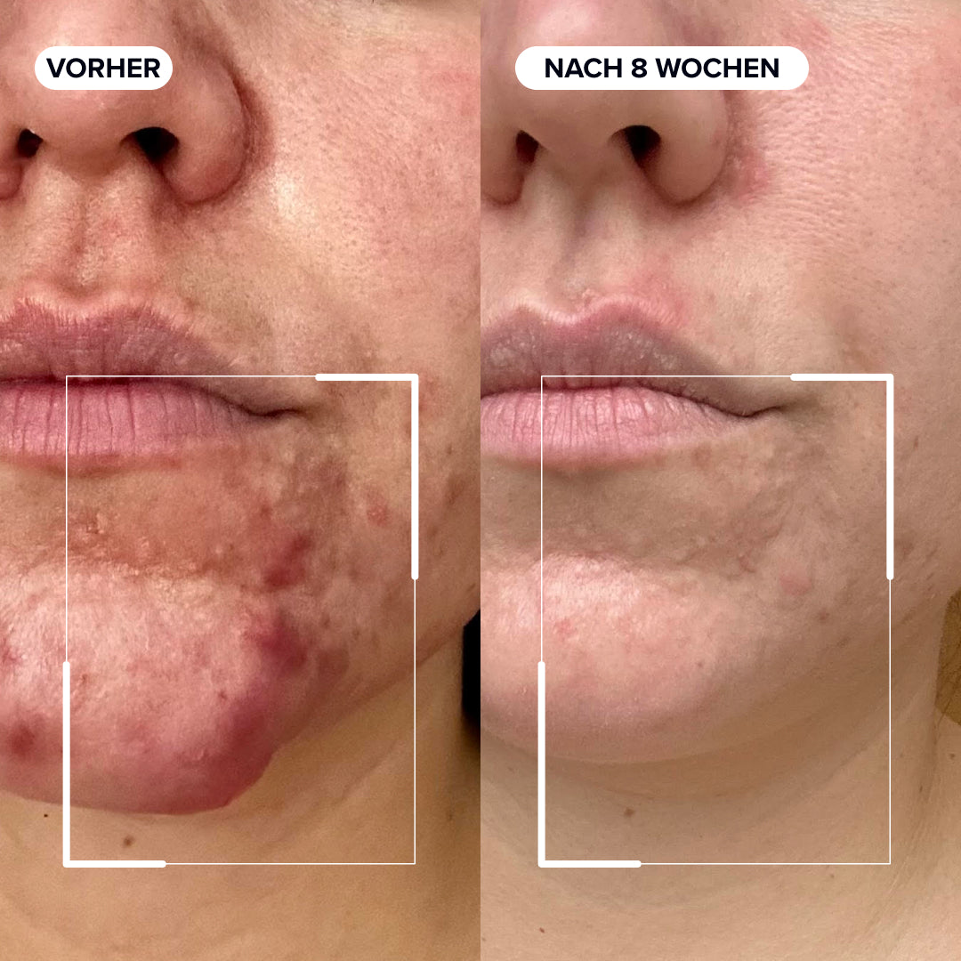 Dermabacs - Image 6